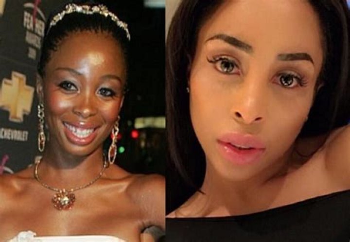 Celebs Who Bleached Their Skin And The Impact